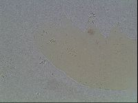 Mesobiotus coronatus image