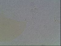 Mesobiotus coronatus image