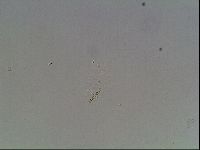 Mesobiotus coronatus image