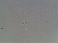 Mesobiotus coronatus image