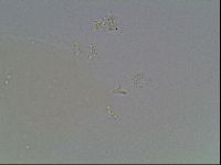 Mesobiotus coronatus image