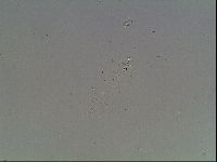Mesobiotus coronatus image