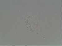 Mesobiotus coronatus image