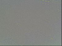 Mesobiotus coronatus image