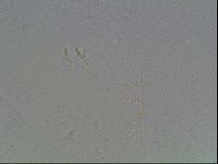 Mesobiotus coronatus image