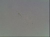 Mesobiotus coronatus image