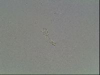Mesobiotus coronatus image