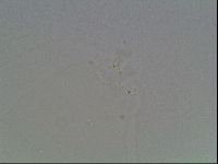 Mesobiotus coronatus image