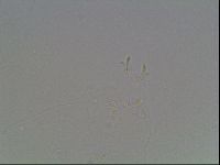 Mesobiotus coronatus image