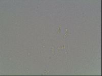 Mesobiotus coronatus image
