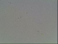 Mesobiotus coronatus image