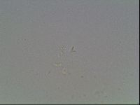 Mesobiotus coronatus image