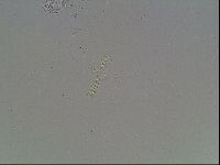 Mesobiotus coronatus image