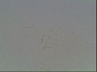 Mesobiotus coronatus image