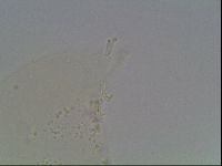 Mesobiotus coronatus image