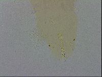 Macrobiotus hibiscus image