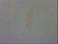 Macrobiotus hibiscus image