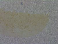 Macrobiotus hibiscus image