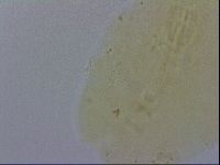 Macrobiotus hibiscus image