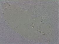 Macrobiotus hibiscus image