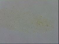 Macrobiotus hibiscus image