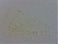 Macrobiotus hibiscus image