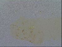 Macrobiotus hibiscus image