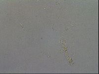 Macrobiotus hibiscus image