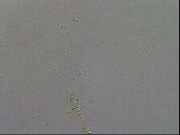 Macrobiotus hibiscus image