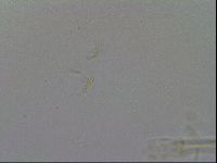 Macrobiotus hibiscus image