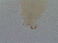 Macrobiotus hibiscus image