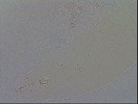Macrobiotus hibiscus image