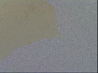 Macrobiotus hibiscus image