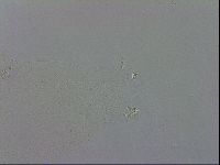Media resource of Macrobiotus hufelandii