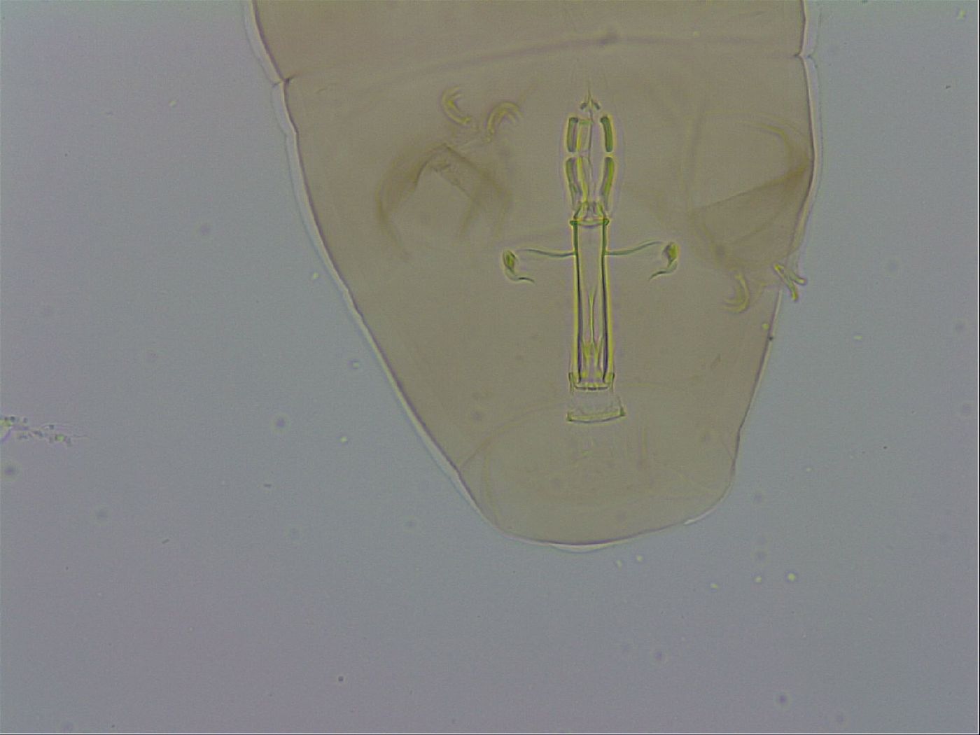 Macrobiotus hufelandi hufelandi image
