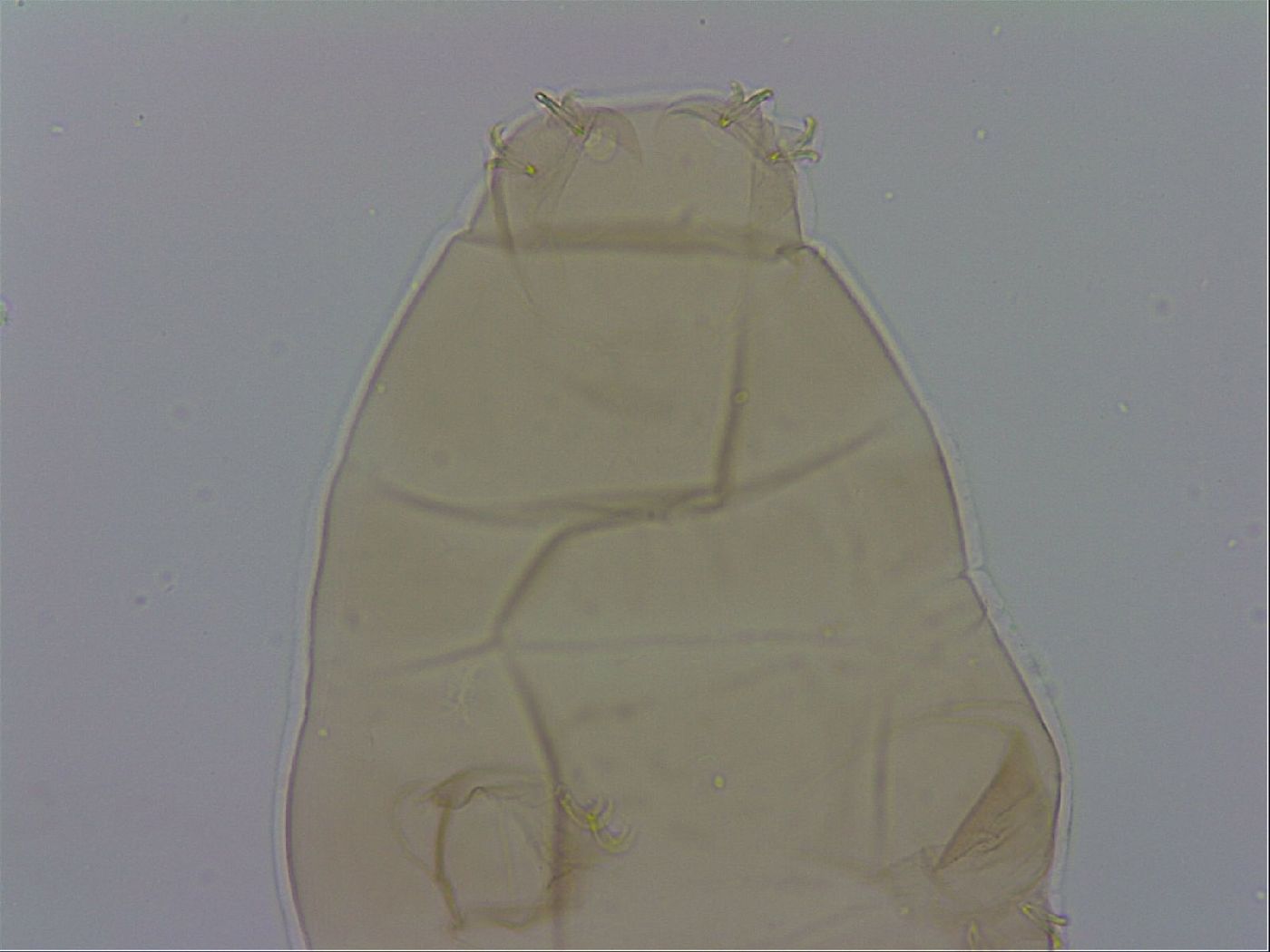 Macrobiotus hufelandi hufelandi image