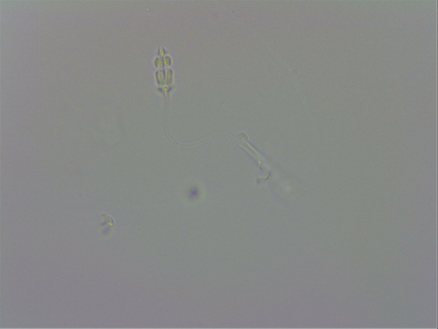 Pilatobius bullatus image