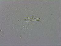 Mesobiotus montanus image