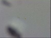 Mesobiotus montanus image