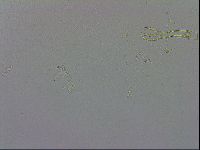 Mesobiotus montanus image