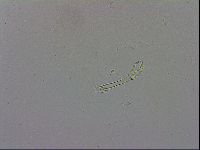 Mesobiotus montanus image