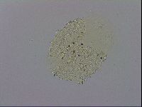 Mesobiotus montanus image