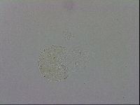 Mesobiotus montanus image
