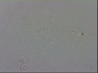 Mesobiotus montanus image