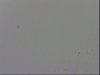 Mesobiotus montanus image