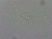 Mesobiotus montanus image