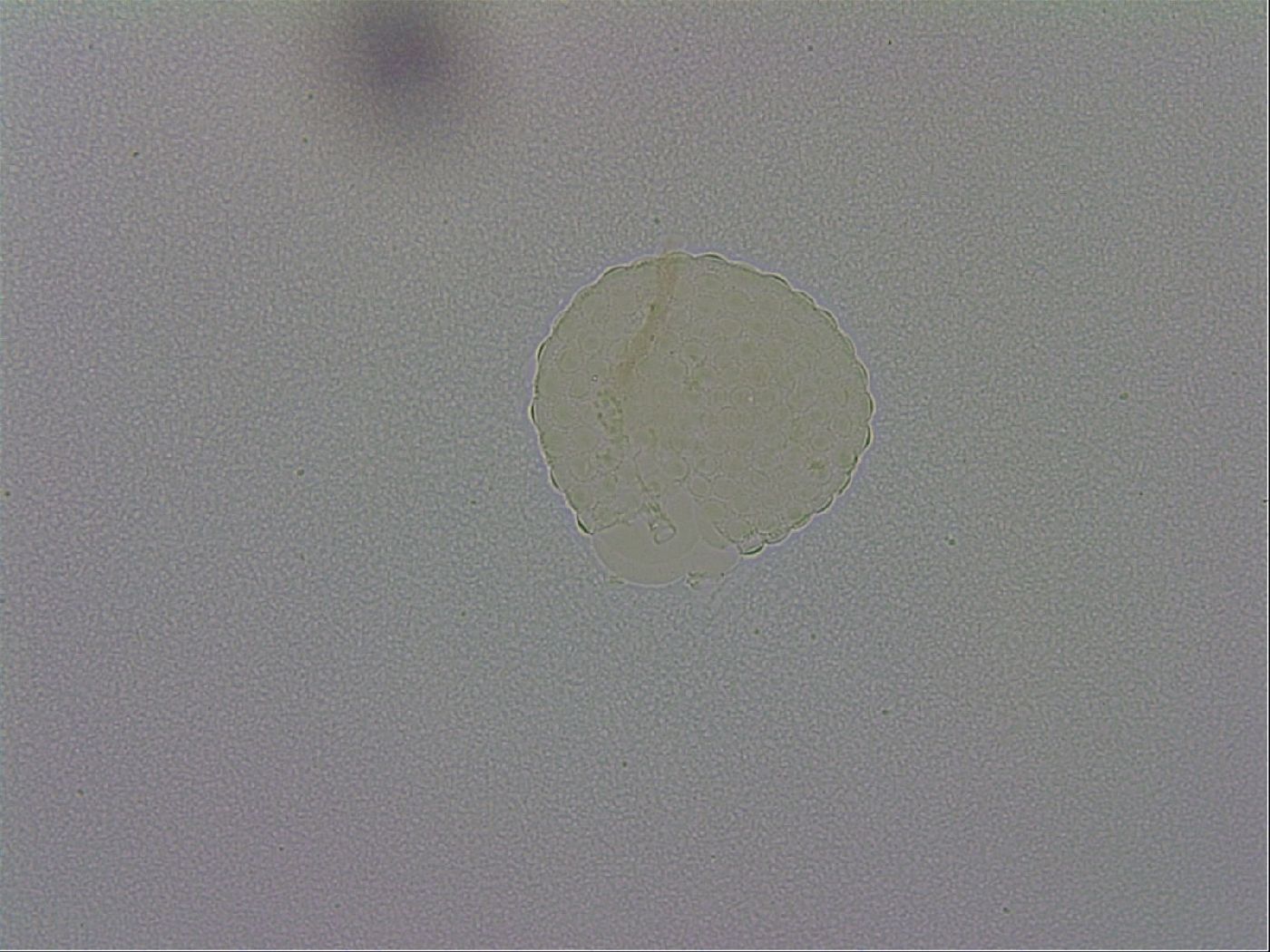 Mesobiotus montanus image