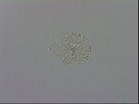Mesobiotus montanus image