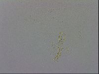 Mesobiotus montanus image