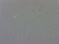 Mesobiotus montanus image